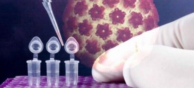 Diagnosticarea HPV folosind testul digene