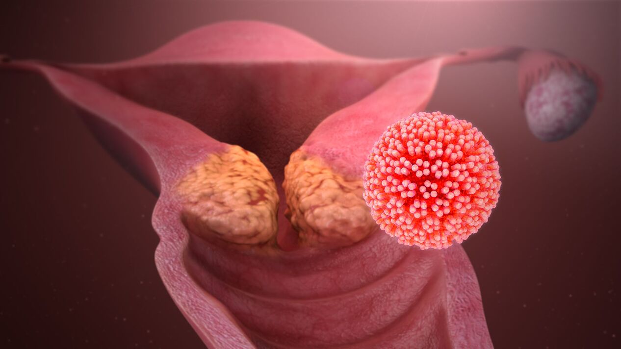 papilomavirus uman în organism